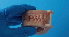 一个完全组装的牙科模型3D打印模型树脂。通过Formlabs照片。