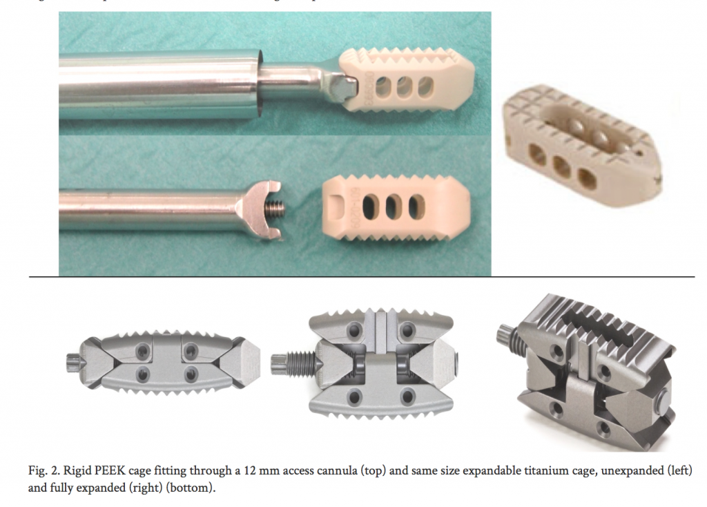 An example of PEEK (top) and titanium (bottom) lumbar cages used in spinal surgery Image via: Rudolf and Christian Morgenstern