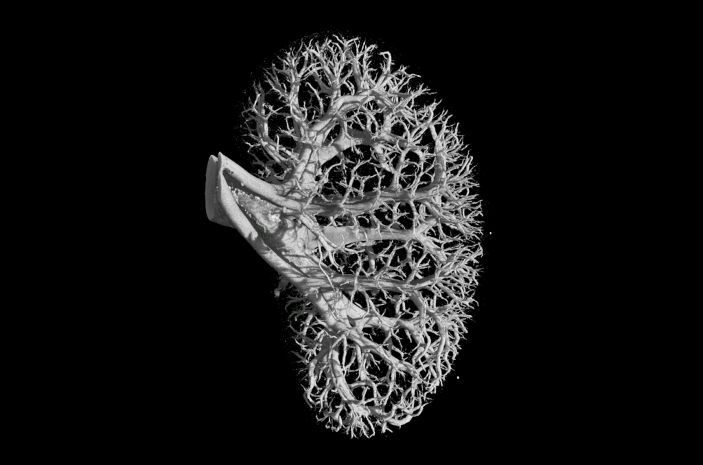 鼠标肾中的血管地图。图片由Ghent University Proeftuinsrtaat的Denis van Loo博士创作