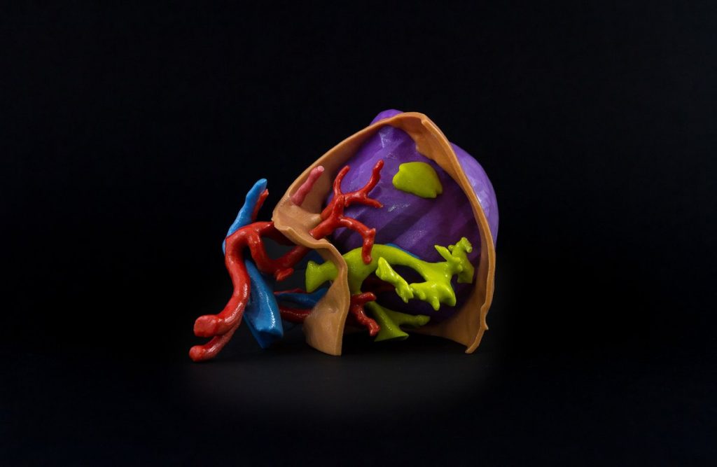 3D打印的解剖心脏模型。通过物质NV的照片