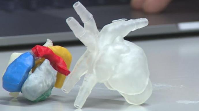 用于手术计划的3D印刷心脏的例子。通过威斯康星大学的照片。