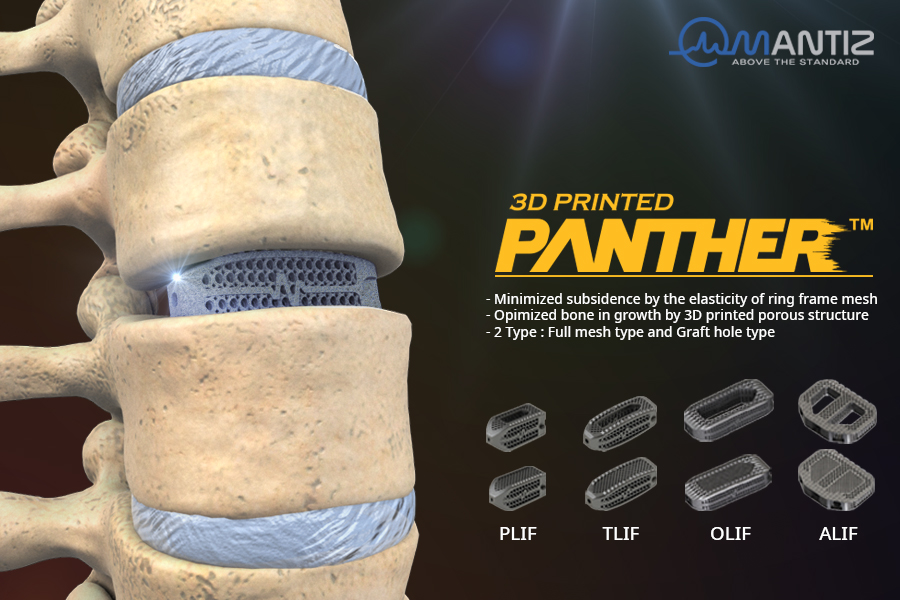 The complete range of PANTHER 3D printed spinal implants. Image via Mantiz