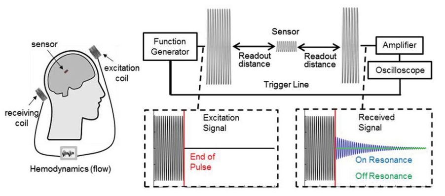 无电池无线血流动力学监测系统的原理图概述与一个植入式流量传感器和两个外部天线线圈。图片来自高级科学。