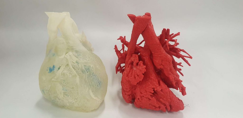 3D Lifeprints技术已被用于一系列医疗应用，包括软打印模型来模拟操作(如图)。照片通过3D Lifeprint。