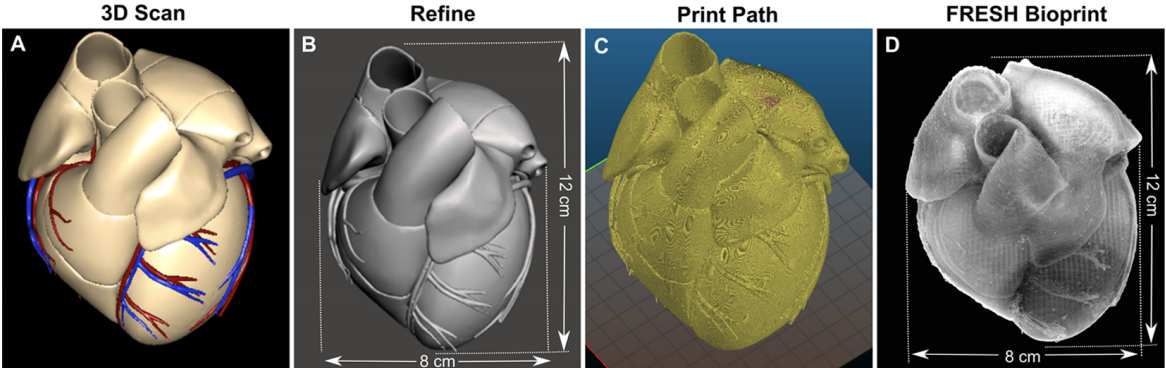 图像显示四个扫描,第一个图像显示了heart based on an MRI scan and the last image is the full-size FRESH print using alginate. Photo via Carnegie Mellon University.