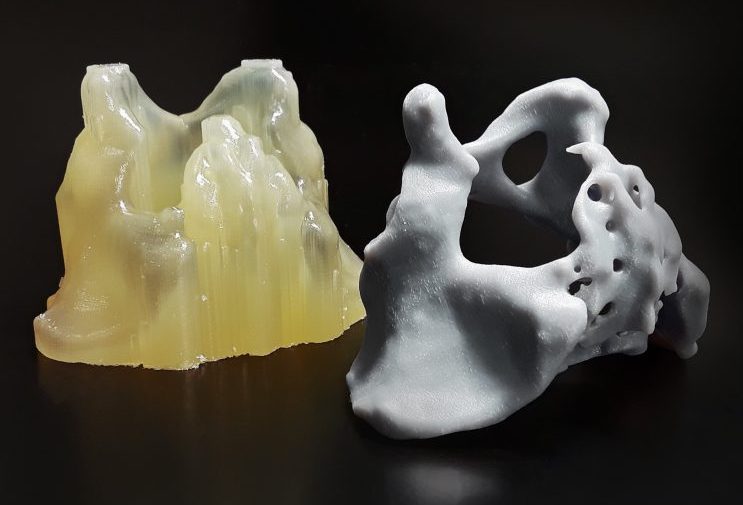 使用后过程的自动化系统后处理后处理的3D打印骨盆模型。通过后进程技术照片。