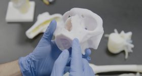 3D打印的解剖模型通过RICOH USA用于医疗保健工作流程。通过Ricoh USA的照片。