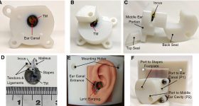 3D印刷结核病未组装的中耳部分的成品图像。图像通过耳鼻喉和神经病学开放。