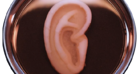 A 3D printed AuriNovo “living” ear for reconstruction in Microtia patients. Photo via 3DBio Therapeutics.