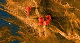 团队生物杂交复合材料的显微照片图像，细胞（红色）播种在胶原蛋白的纤维结构域（黄色）上。图片通过康奈尔大学。