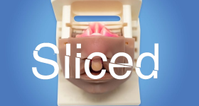 Sliced logo on the 3D printed cleft lip simulator. Photo via Simulare Medical.
